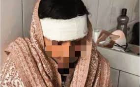 देहरादून में युवती पर फिर हिंसक हमला, चंद्रबनी चौक के पास वारदात